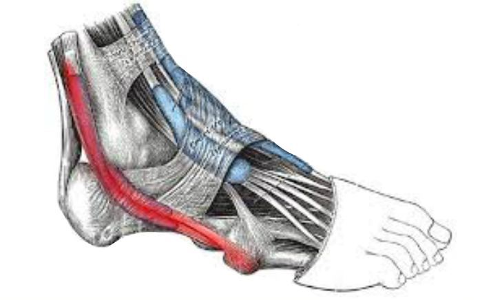 Image of foot showing Peroneal Tendonitis, Socal Foot Ankle Doctors, Peroneal Tendonitis