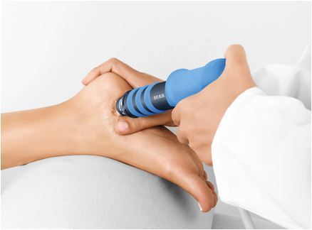 Image of shockwave therapy procedure, Socal Foot Ankle Doctors, Shockwave therapy Los Angeles