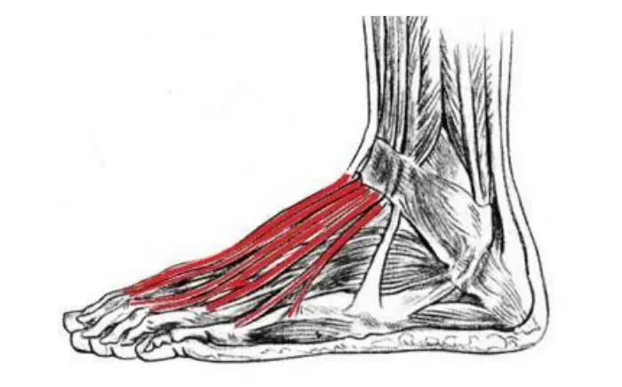 Image of Foot showing Extensor tendonitis , Socal foot Ankle Doctors, Extensor tendonitis