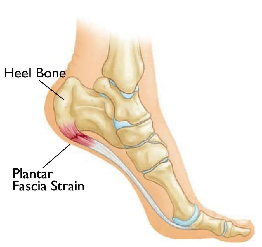 Image of Foot Heel pain treatment , Socal Foot Ankle Doctors, Heel pain treatment Los Angeles