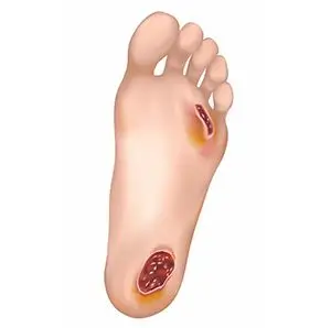 Image of advanced Wound Care, Socal Foot Ankle Doctors, Foot & Ankle Treatments