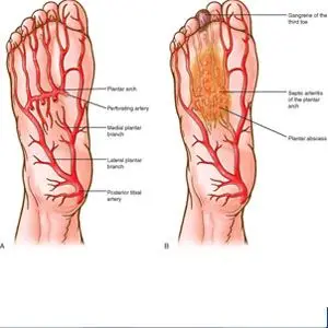 Image of Foot showing vascular testing, Socal Foot Ankle doctors, Foot & Ankle Treatments