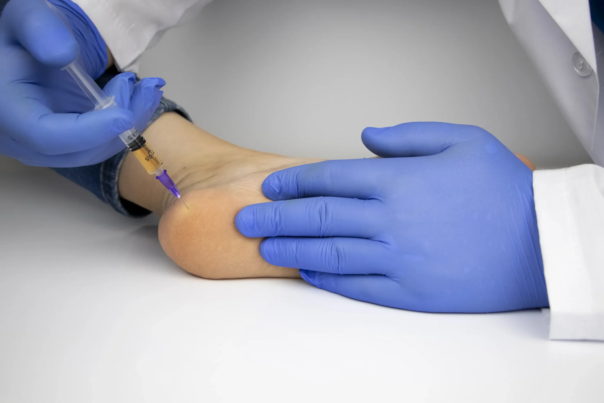 PRP Therapy (Platelet-Rich Plasma Injections)