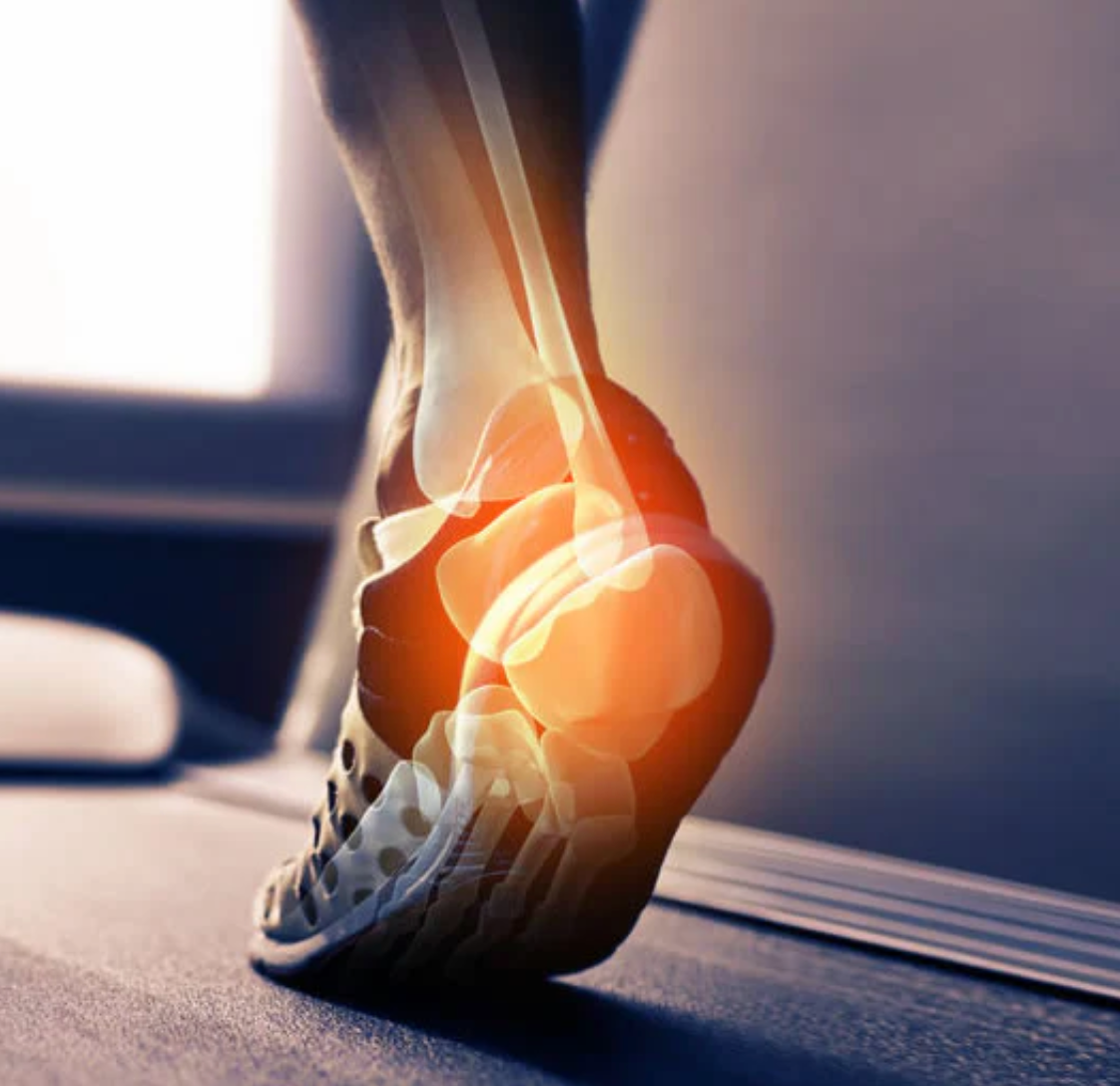 Gait Analysis & Biomechanical Evaluations