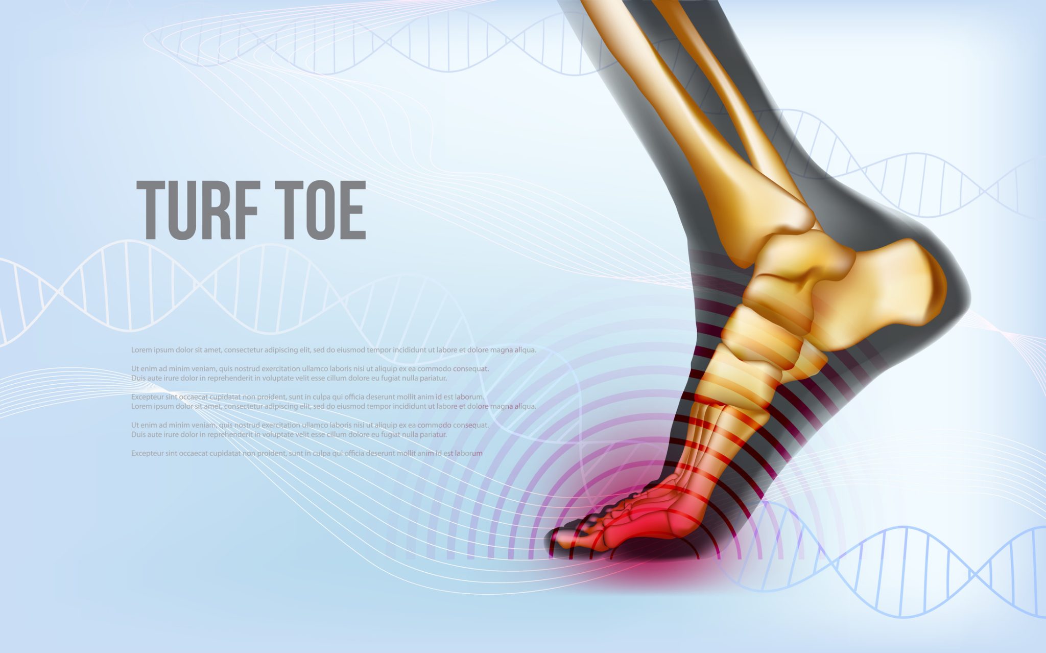 Image of Foot with condition Tarsal Tunnel Syndrome, Socal Foot Ankle Doctors, Tarsal Tunnel Syndrome