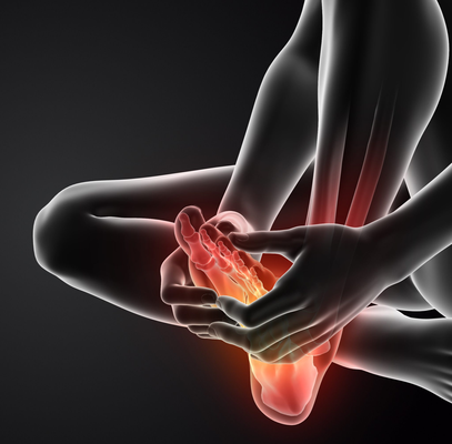 Image of Foot with Bunion condition, Socal Foot Ankles Doctors, Common Foot & Ankle Disorders